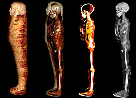 Компьютерная томография древнеегипетской мумии «золотого мальчика» выявила 49 драгоценных амулетов