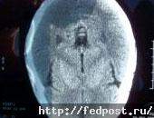 При сканировании мозга австралийской пациентки на снимке выявился…образ Христа